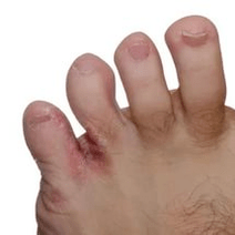 grybelis tarp pirštų